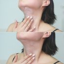 이중턱 턱밑살 처짐 고민이라면?! KYYB 킵 120도크림 추천!