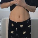 차 | 인천 구월동 지방분해주사 내돈내산 복부 4회차 후기