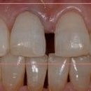 스마일홍치과의원 이미지