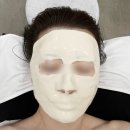 구로-구로-구로-1451 | 구디피부관리 더율에스테틱 3V윤곽관리 받고 달라진 얼굴선 후기