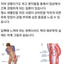 장경인대 이미지