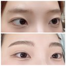 신사눈썹문신 짱구눈썹 걱정 없는 자연스러운 눈썹결 후기 I 라라쉬 신사압구정점 I