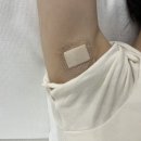 연세온성형외과의원 네이버블로그