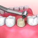 크라운사거리 이미지