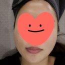강남 슈링크유니버스 효과 갤러리 피부과 리프팅 내돈내산 후기