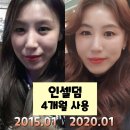 인셀덤판교 | #인셀덤사용후기 #인셀덤맞춤케어 #인셀덤사용방법