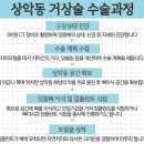 에스프라임 이미지