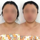 대구칠곡 피부관리 더빛나스킨케어 작은얼굴 윤곽테라피 후기