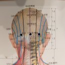 폐암 등(8.13/전유진님 침술) 이미지