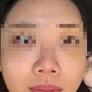 밸라스킨앤바디