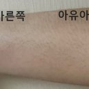 아유스킨 이미지