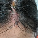 에스비메디칼 이미지