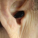 오티콘보청기 고양덕양점 이미지