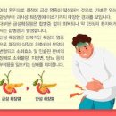 급성 췌장염 만성 췌장염 원인 이미지