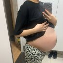 국민건강보험공단일산병원 | 국민건강보험공단 일산병원 제왕절개 수술 첫날 , 거대낭소낭종(21cm) 난소물혹 제거