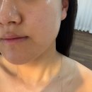 그리다 | [청주] 청주 금천동 피부관리 잘하는 곳/ 미녀를 그리다 후기