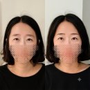 서울교통공사(논현역 7호선) | [논현역반영구] 내돈내산 대만족! 리얼페이스 자연스러운 눈썹문신 후기 (ft.눈썹펌)
