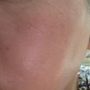 (주)아이알엔디벨로퍼 | ※한정수량※ 화제의 루비알엔 피코샷 크림! 온가족이 함께 써본 기미 케어