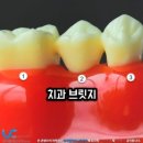 그림치과기공소 이미지