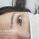포가_D
