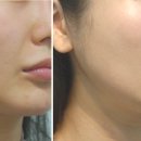 슈어스성형외과의원 이미지