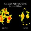 자폐증(Autism), 자폐스펙트럼장애(ASD) 자연치료와 오티짐(Autizym Protocol) 이미지