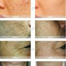 참좋은피부과의원 이미지