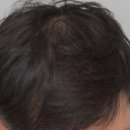 미소큰약국 이미지