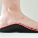 선정형외과 네이버블로그
