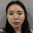 동일각 | [대구 올타이트리프팅] 울쎄라 알아보다가 결국 이걸로 턱선 되살림 (B&amp;A 충격주의)