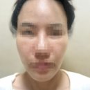 구로-구로-구로-1080 | 신림피부관리 구로피부관리 하이필스킨 구로본점 관리 후기