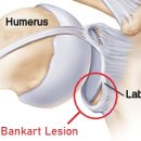 이재규 스포츠 재활 이미지