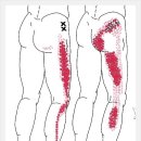 중둔근과 소둔근 연관통증[Gluteus Medius/Gluteus Minimus Referral Pain] 이미지