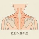 목 어깨 통증, 혹시 근막통증증후군? 트리거포인트로 알아보는 진짜 원인 이미지