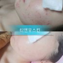 은에스테틱피부관리실