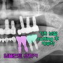 새로치과기공소 이미지