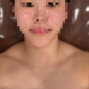 비너스사우나 | 옷핏 살아나는 비너스웨딩 승모근 주사 3주차 후기