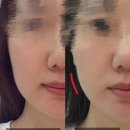 송화로35번길 23 건물주차장 | 비엣스파 :: 강릉에스테틱 베트남테라피 윤곽관리 후기!!