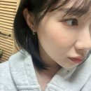 얼굴편평사마귀 무제한 제거 명동한의원에서 깔끔하게 끝낸 후기
