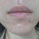 휘온에스테틱 | 서현역피부관리 휘온에스테틱 트로이필 후기