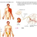 침술의 이해 - 연관통 이미지