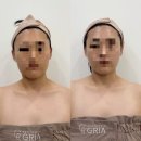옥길동 446-2 | 부천 옥길동 피부관리 제대로 받은 후기 그리아에스테틱