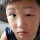 버그클린 이미지