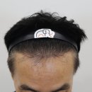 압구정맘모스헤어라인의원 이미지