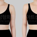 팔라인