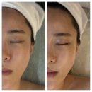 볼륨업-셀프스피커 만들기 | [부천 피부관리 추천] 서아담에스테틱에서 받은 홍조·윤곽 맞춤 케어 신부피부관리 솔직후기