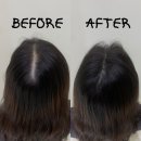 백현중학교 | 분당SMP/탈모 커버 잘하는 곳에서 가르마 두피 채움 1회차 받은 후기ㅣ갓스칼프 분당판교점