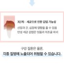 화악농장 | 강아지 올바른 양치를 위한 덴탈케어 "페디슨 칫솔" 실사용 후기