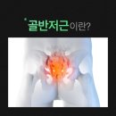 큐어핏 이미지