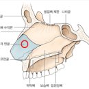 노블앤코성형외과 네이버블로그